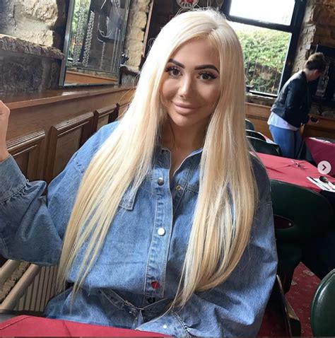 Chloe Ferry's surgery timeline following recent breast reduction